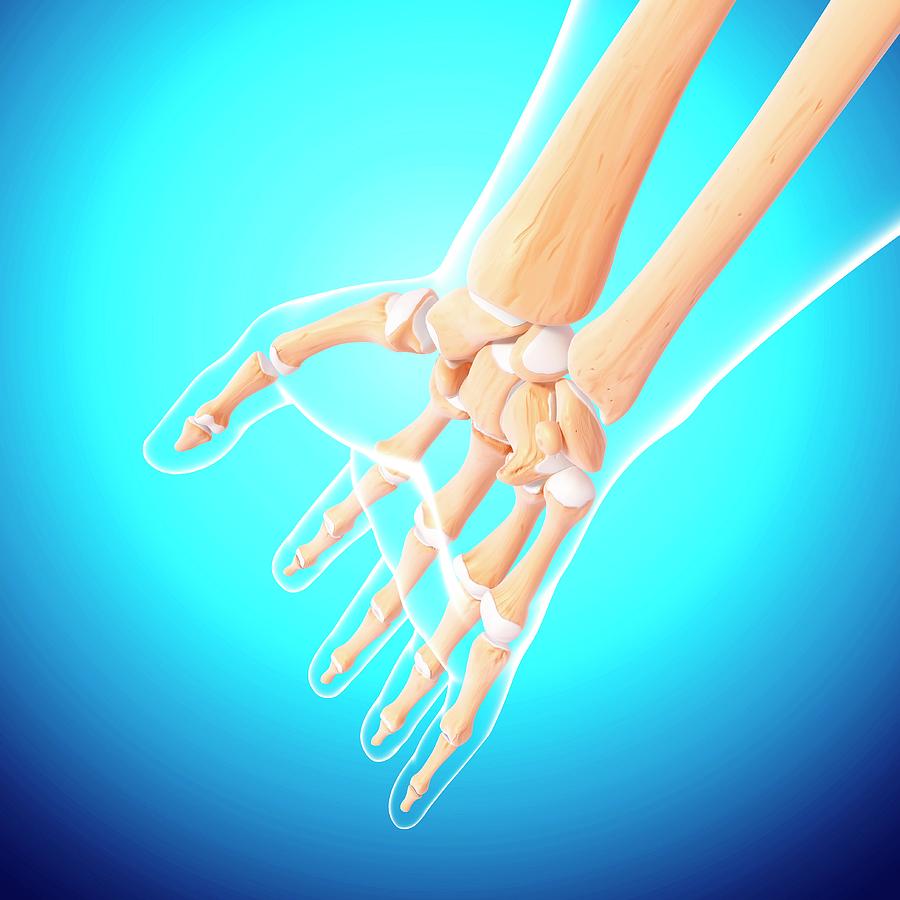 Human Arm Bones Photograph by Pixologicstudio/science Photo Library