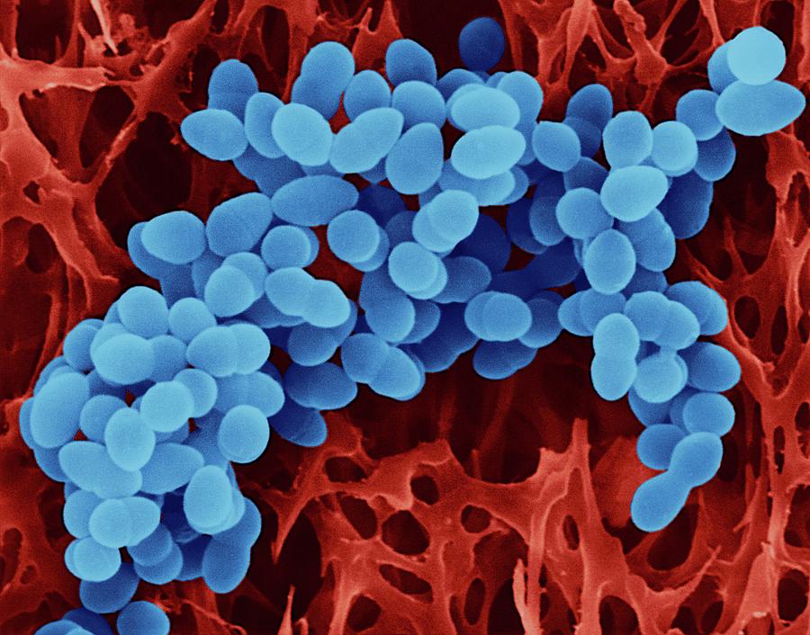 Multiple Photograph - Staphylococcus Aureus #23 by Dennis Kunkel Microscopy/science Photo Library