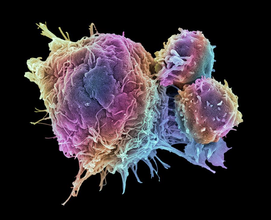 Antigen Photograph - Cancer Cell And T Lymphocytes #24 by Steve Gschmeissner