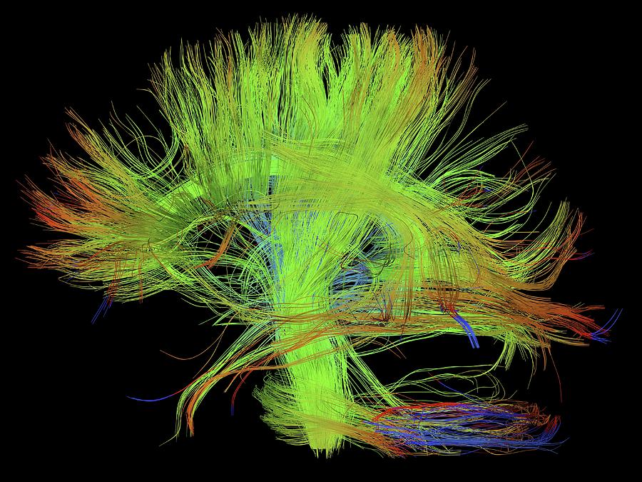 Brain Scan Photograph - White Matter Fibres Of The Human Brain #24 by Alfred Pasieka