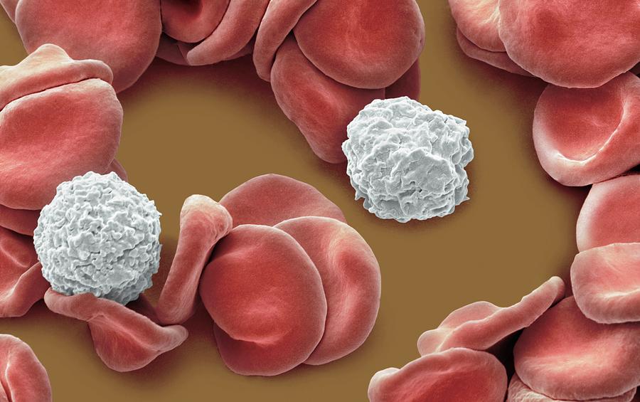 Basophil Photograph - Blood From Wound Site #26 by Steve Gschmeissner/science Photo Library