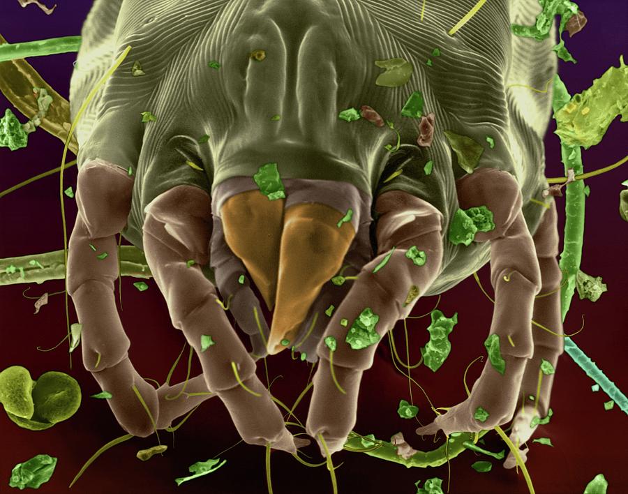 Dust Mite #26 Photograph by Dennis Kunkel Microscopy/science Photo Library