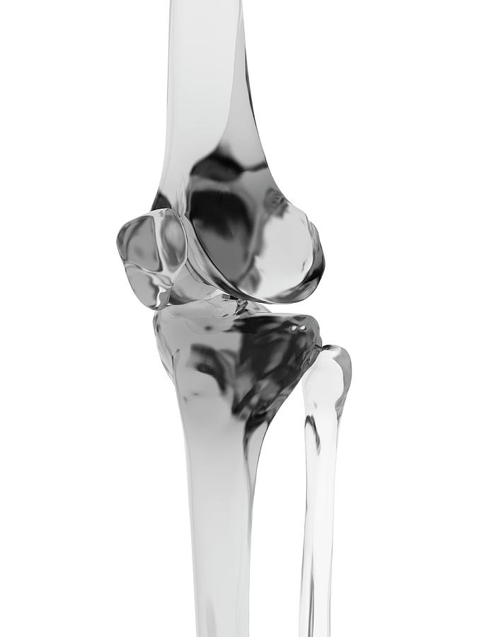 Illustration Photograph - Human Knee Joint #28 by Sciepro