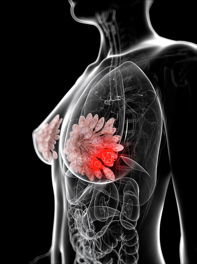 Breast anatomy, artwork - Stock Image - C008/4452 - Science Photo