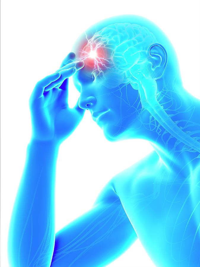 Illustration Photograph - Human Headache #29 by Sebastian Kaulitzki
