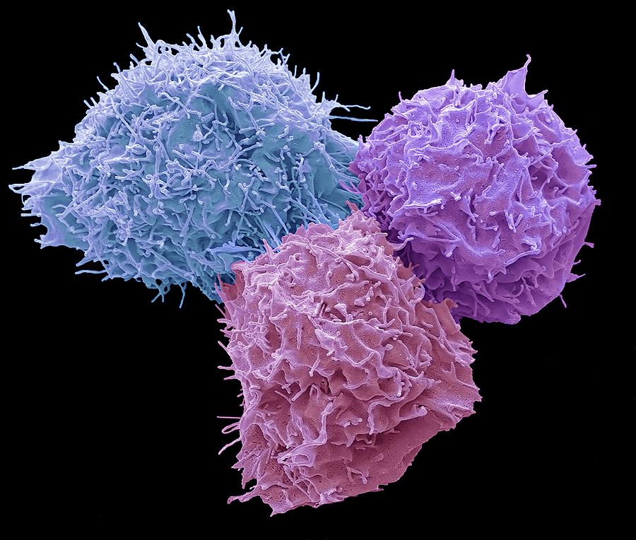 293t Cells In Culture Photograph by Steve Gschmeissner/science Photo Library