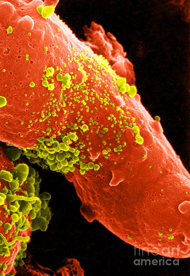 Aids Virus #3 Photograph by Dr. Cecil H. Fox