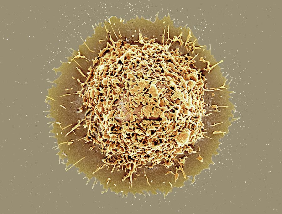 Ball Photograph - Alveolar Macrophage #3 by Microscopy Core Facility, Vib Gent