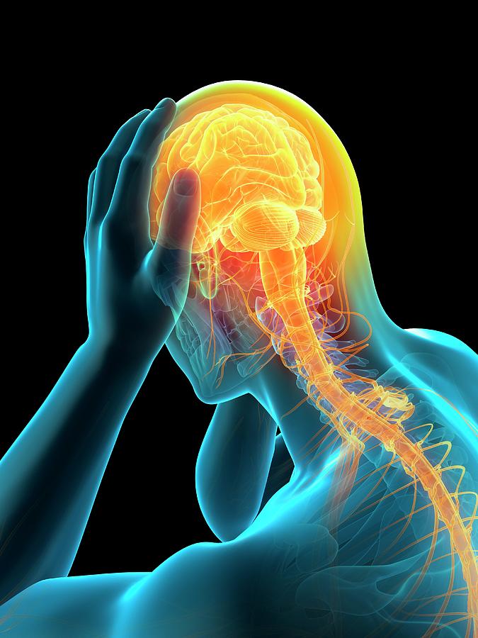 Anatomy Of Person With Headache Photograph By Sebastian Kaulitzki