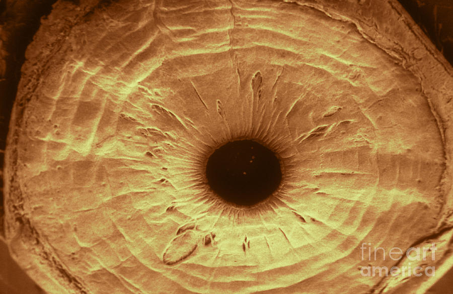 Anterior Surface Of Iris, Sem #3 Photograph by Ralph C. Eagle, Jr.