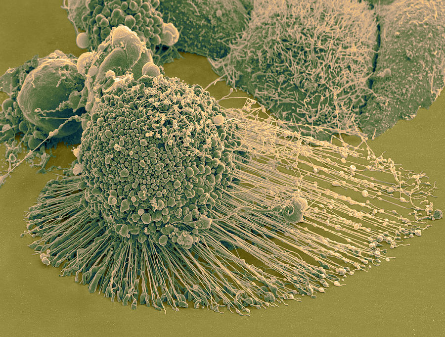 Apoptotic Hela Cell, Sem #3 Photograph by Science Source