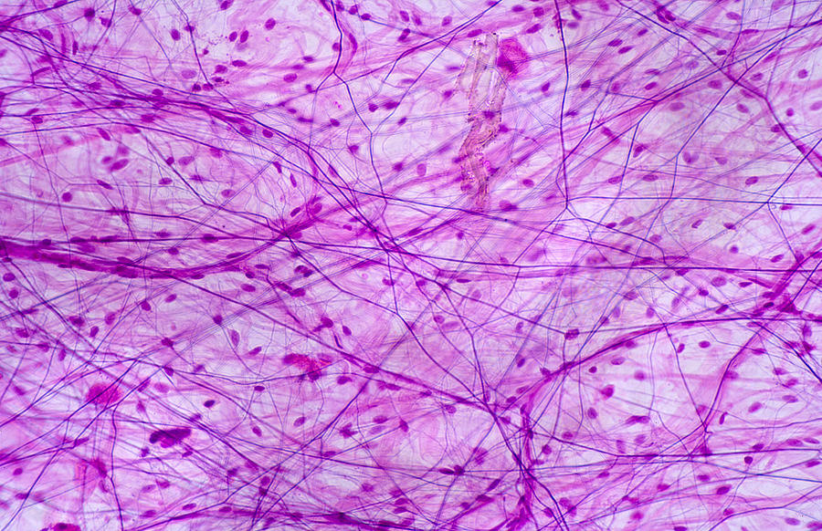 connective tissue areolar