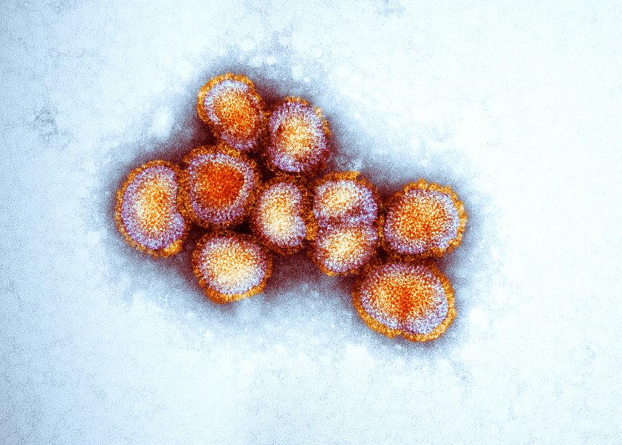 Avian influenza virus, TEM Photograph by Science Photo Library | Fine