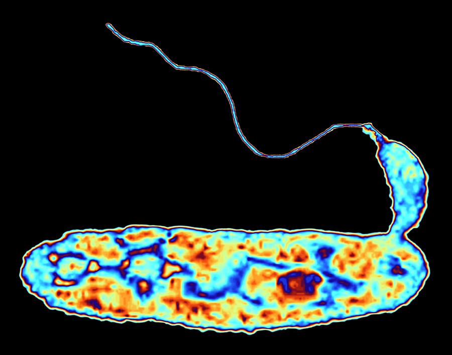 Bacteria (bdellovibrio Bacteriovorus) #3 Photograph by Alfred Pasieka/science Photo Library