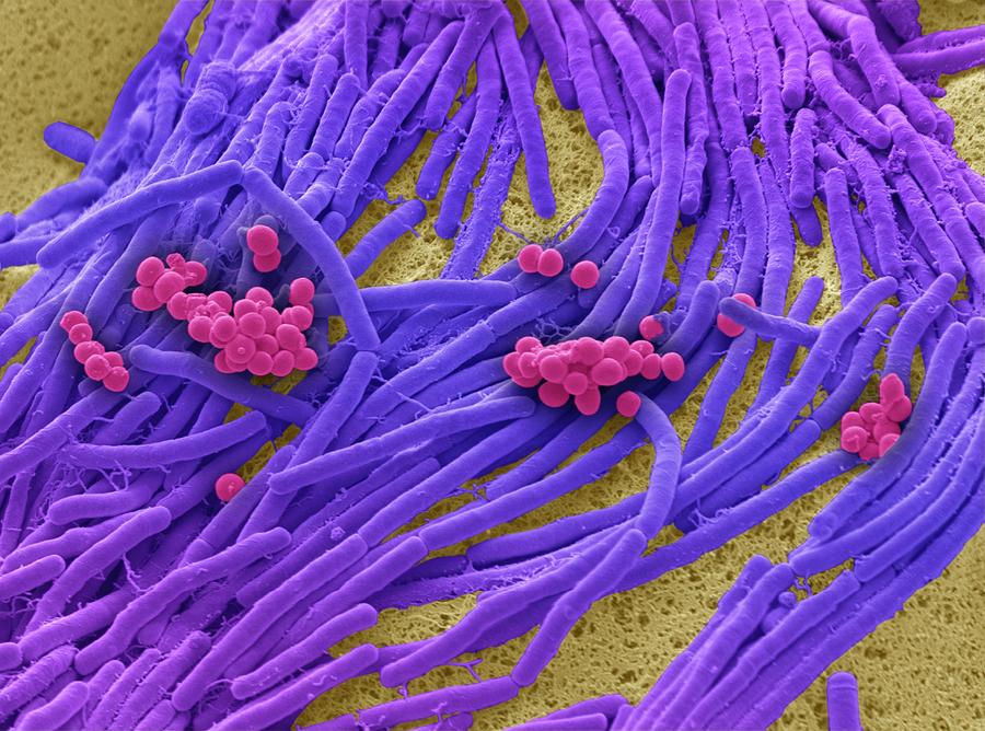 Bacteria Found On Mobile Phone Photograph By Steve Gschmeissner Science