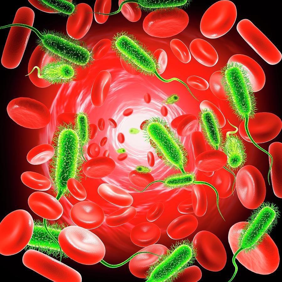 bacterial-blood-infection-photograph-by-pixologicstudio-science-photo