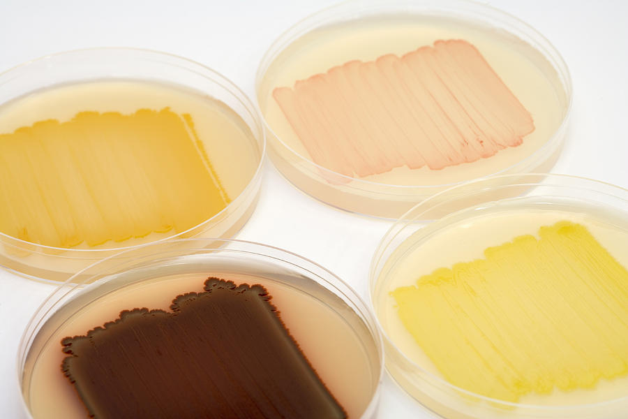 Bacterial Culture Plates #3 Photograph by Science Stock Photography