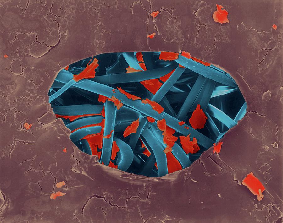 Band-aid With Dried Blood #3 Photograph by Dennis Kunkel Microscopy/science Photo Library