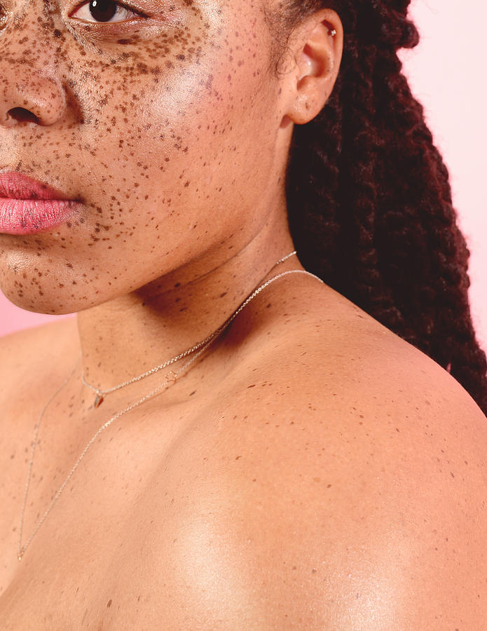 Beauty Portrait of Young Confident Woman with Freckles #3 Photograph by Rochelle Brock / Refinery29 for Getty Images