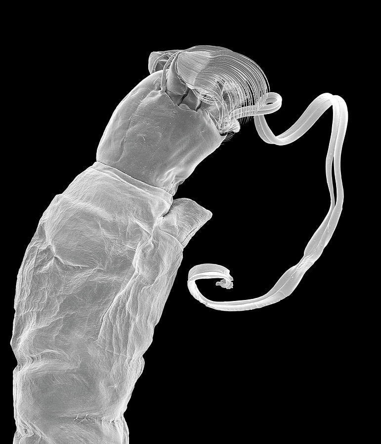 Black Fly Larva #3 Photograph by Dennis Kunkel Microscopy/science Photo Library
