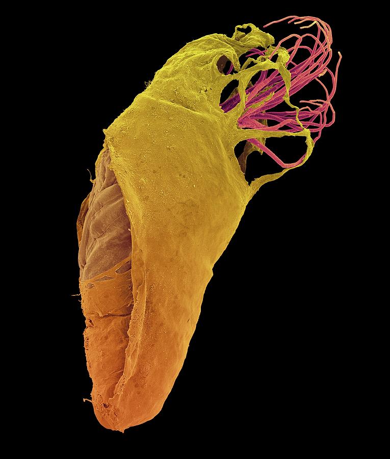 Black Fly Pupa #3 Photograph by Dennis Kunkel Microscopy/science Photo Library
