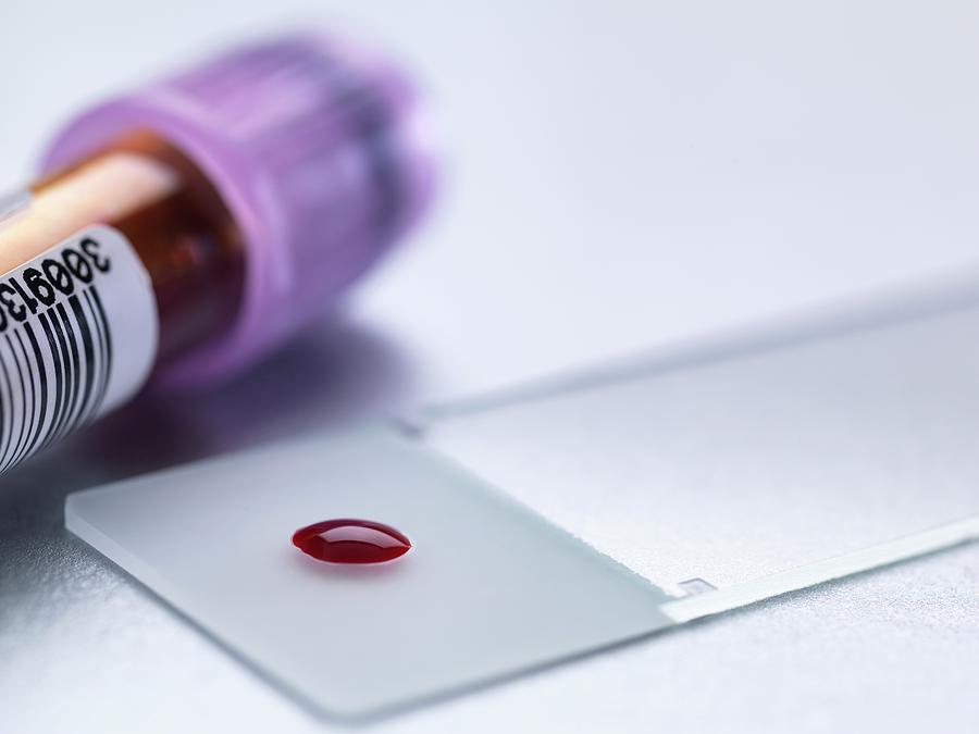 Blood Test #3 Photograph by Tek Image