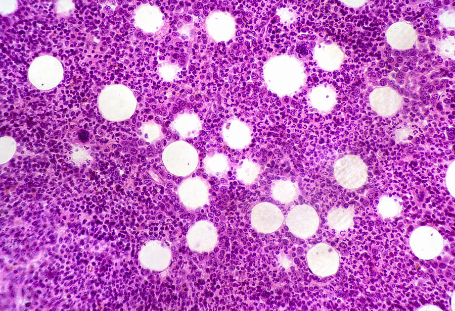 Bone Marrow Section, Lm #3 Photograph by Science Stock Photography
