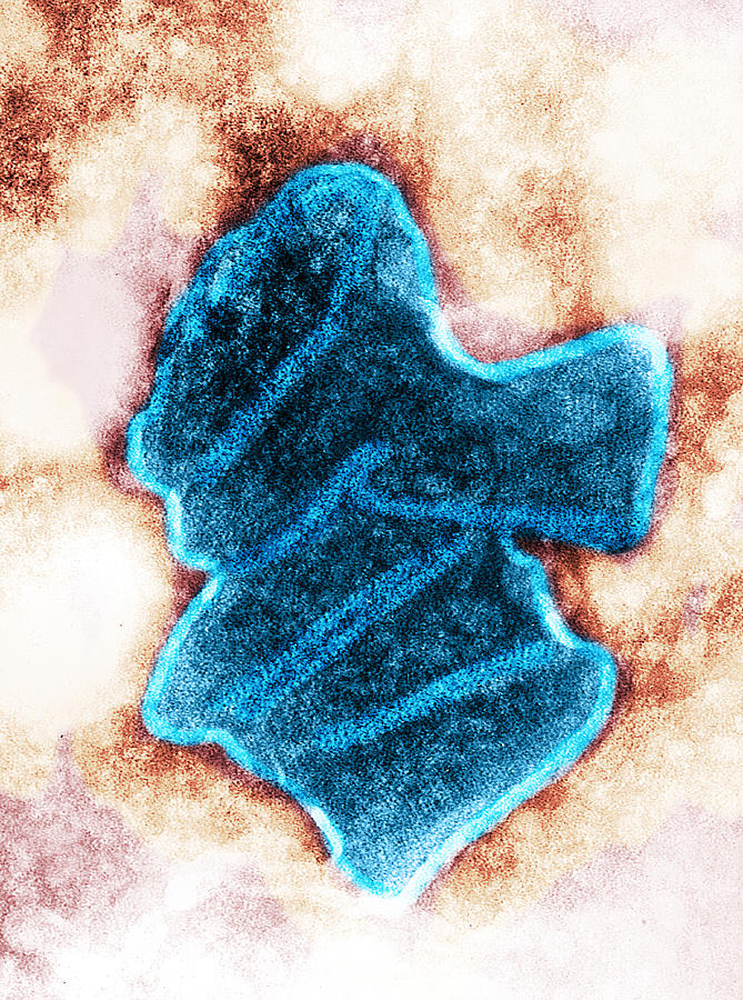 Bovine Ephemeral Fever Virus, Tem #3 Photograph by Science Source