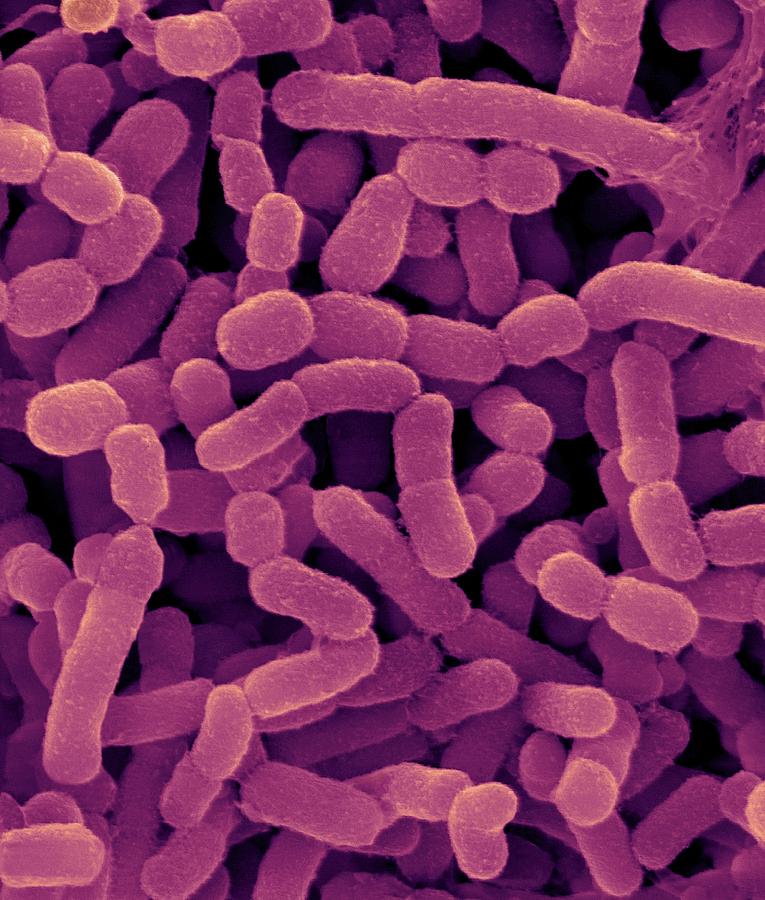 Bovine Rumen Bacterium #3 Photograph by Dennis Kunkel Microscopy/science Photo Library
