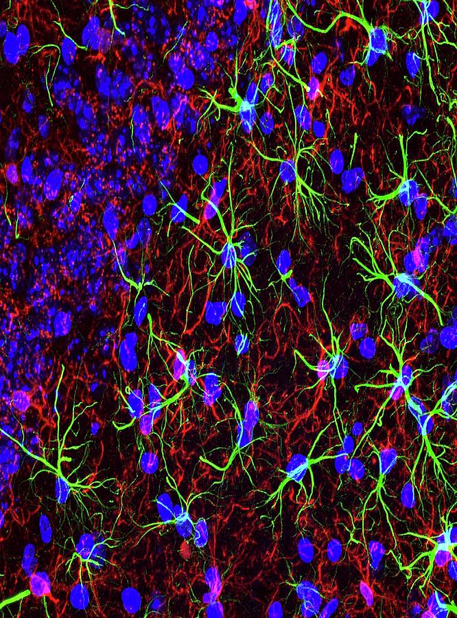 Brain Cells #3 Photograph by Dr. Chris Henstridge