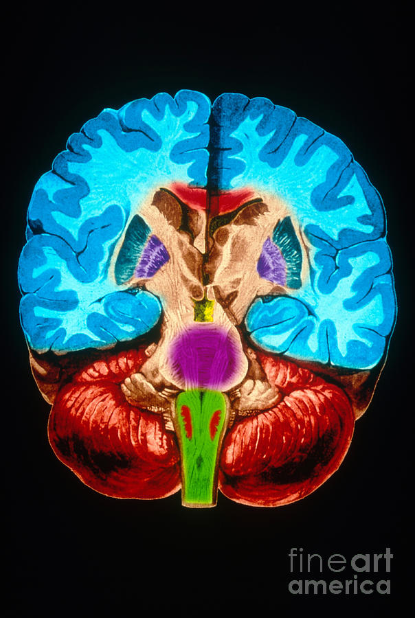 Brain, Coronal Section #3 Photograph by Scott Camazine