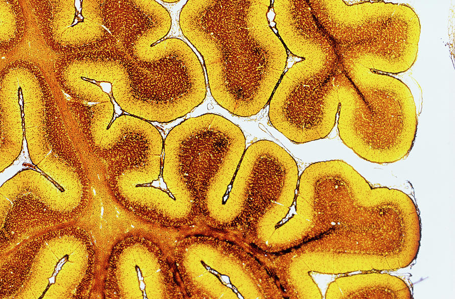 Brain Tissue Photograph by Innerspace Imaging/science Photo Library