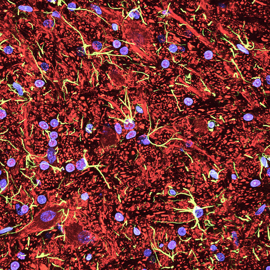 Brainstem Nerve Cells #3 Photograph by C.j.guerin, Phd, Mrc Toxicology Unit/ Science Photo Library