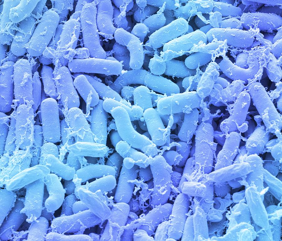Breast Milk Bacteria #3 Photograph by Steve Gschmeissner/science Photo Library