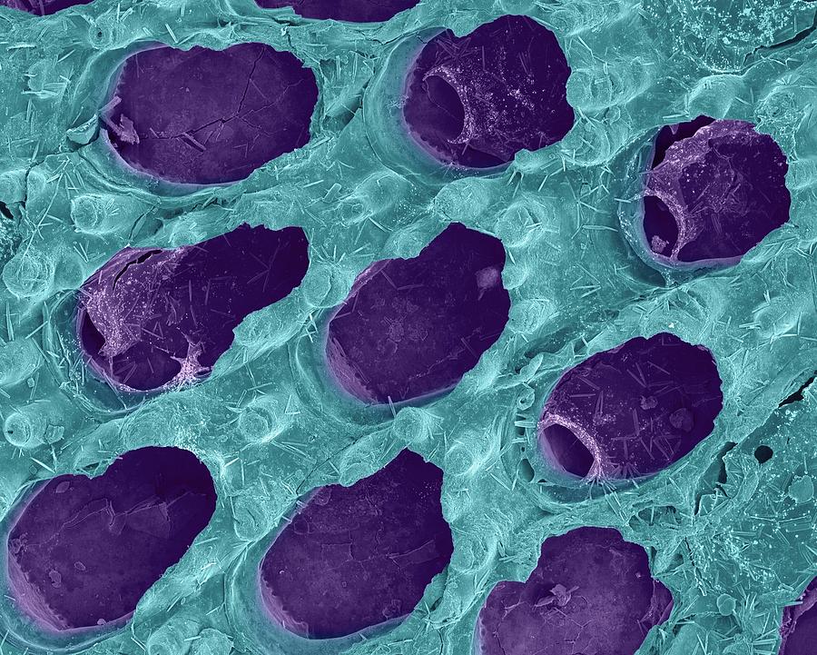 Bryozoan #3 Photograph by Dennis Kunkel Microscopy/science Photo Library