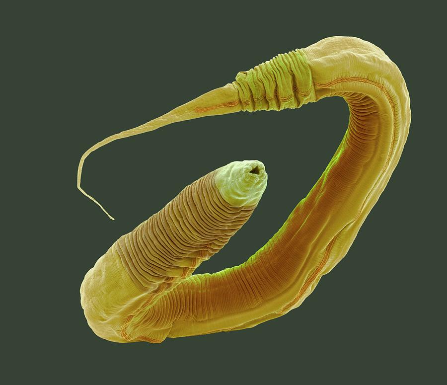 C. Elegans Worm #3 Photograph by Steve Gschmeissner
