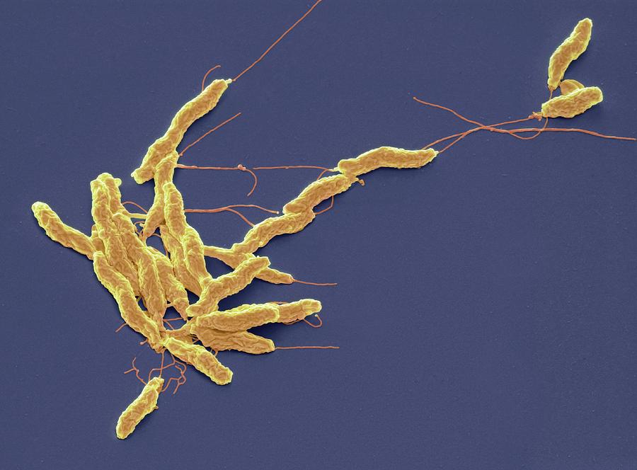Campylobacter Jejuni Bacteria #3 Photograph by Steve Gschmeissner