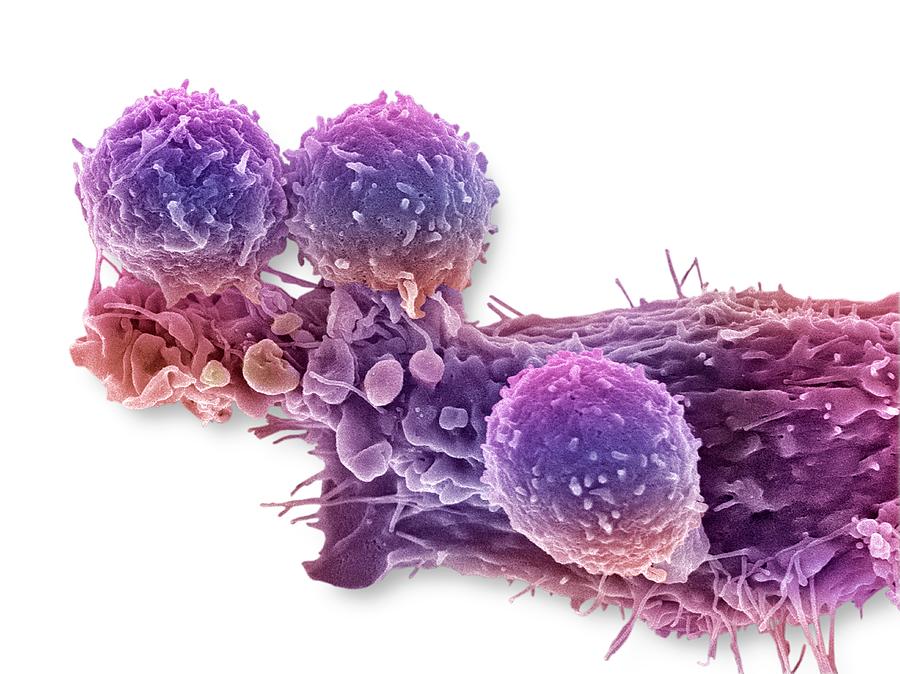 Cancer Cell And T Lymphocytes #3 Photograph by Steve Gschmeissner