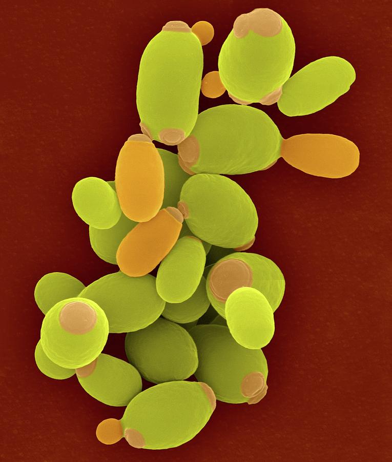 Candida Yeast Candida Parapsilosis 3 By Science Photo Library