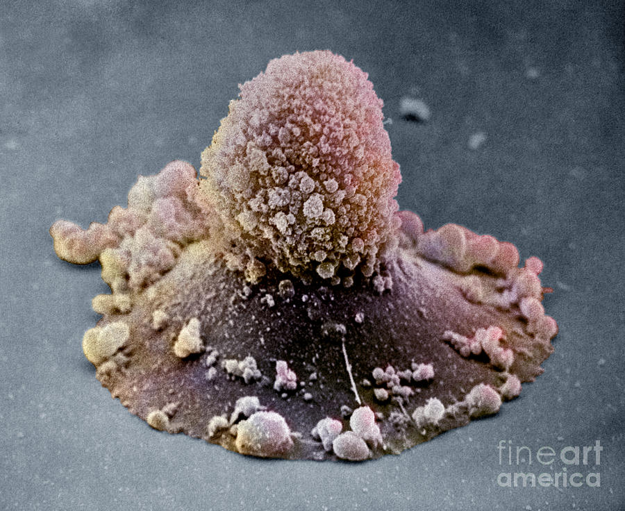 Carcinoma Cell Apoptosis #3 Photograph by David M. Phillips