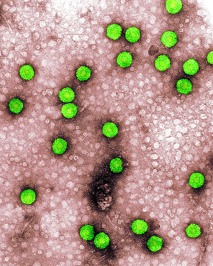 Virus Particle Photograph - Cauliflower Mosaic Virus #3 by Centre For Bioimaging, Rothamsted Research/science Photo Library