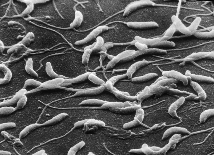 Caulobacter Crescentus, Sem #3 Photograph by Biology Pics