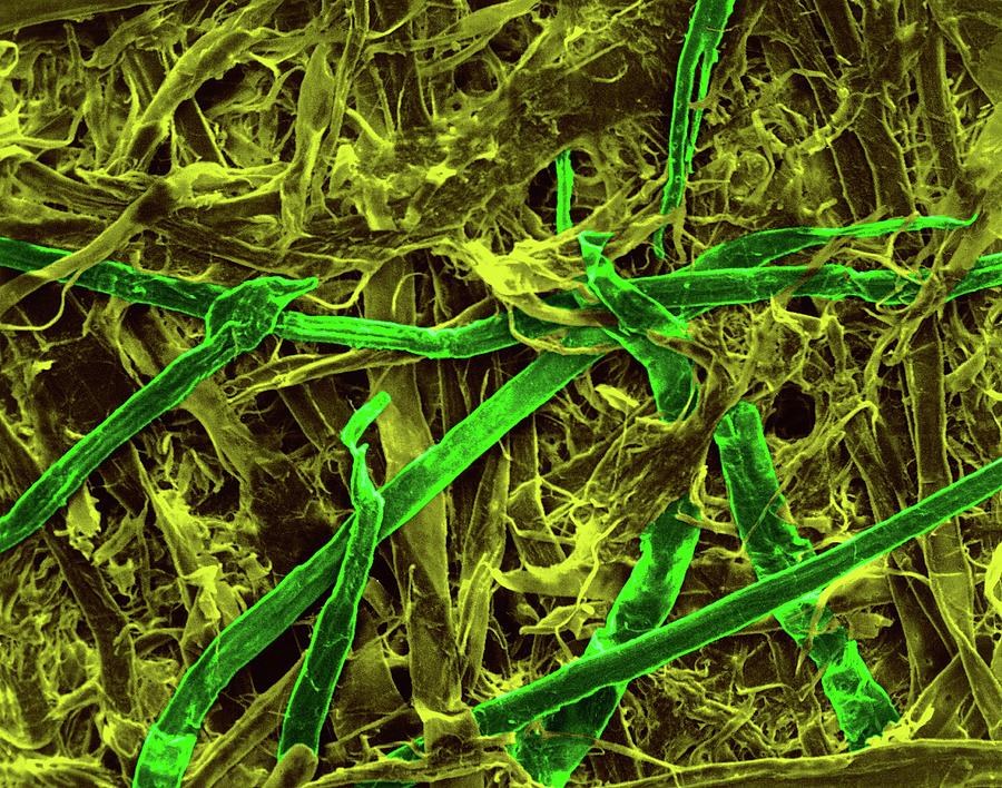 Cellulose Fibres (paper Towel) #3 Photograph by Dennis Kunkel Microscopy/science Photo Library
