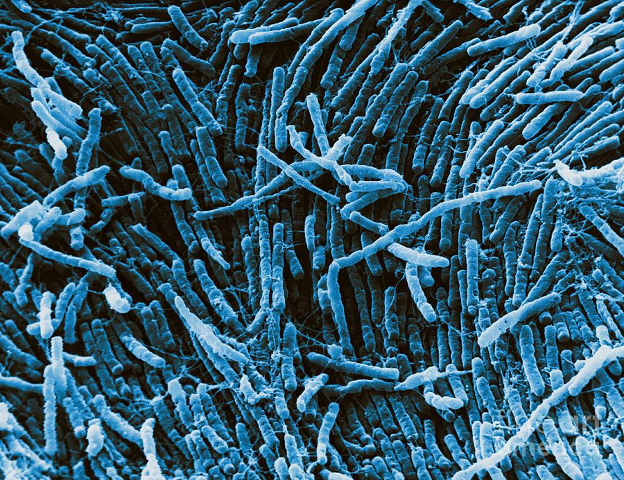 Clostridium, Sem #3 Photograph by David M. Phillips