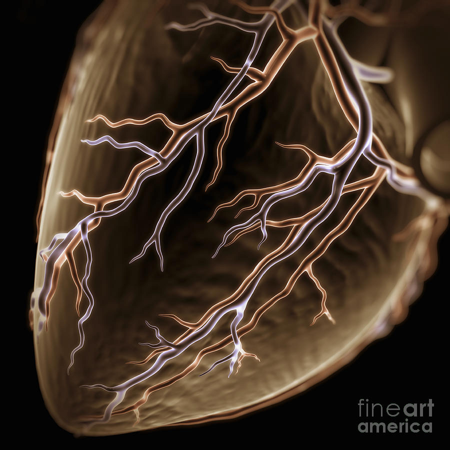 Coronary Blood Supply #3 Photograph by Science Picture Co