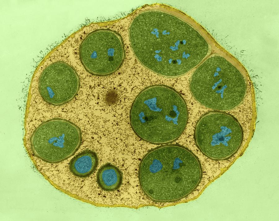 Cyanobacteria Endospores (dermocarpa Sp.) #3 Photograph by Dennis Kunkel Microscopy/science Photo Library