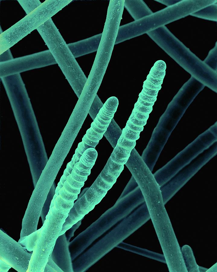 Cyanobacterium (scytonema Sp.) #3 Photograph by Dennis Kunkel Microscopy/science Photo Library