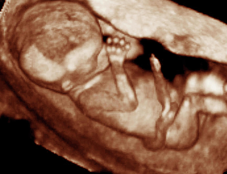 3-d Foetal Ultrasound Photograph by Ge Medical Systems/science Photo Library