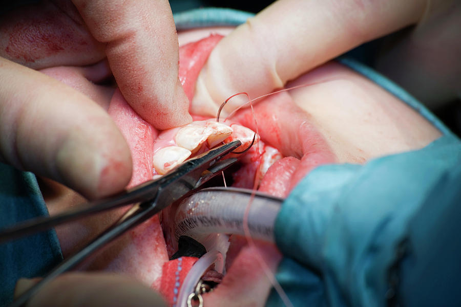 Dental Surgery #3 Photograph by Antonia Reeve/science Photo Library