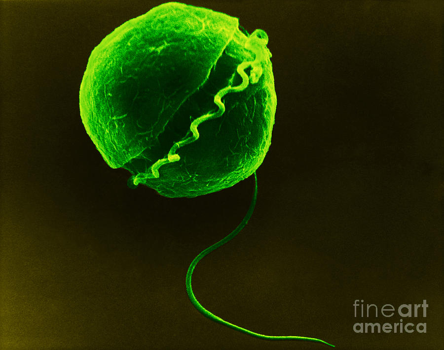 Dinoflagellate, Sem #3 Photograph by David M. Phillips
